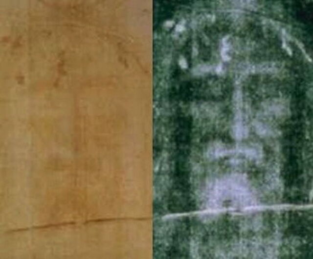 radiografías de la Sábana Santa de Turín